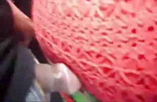 女朋友抓住了医生 赤裸裸的照片